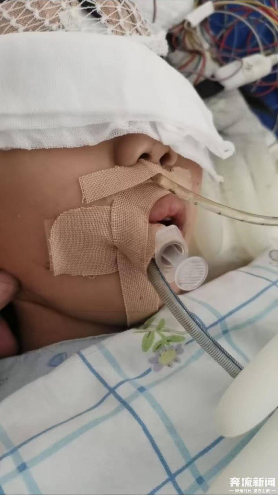 9岁女童术后成了植物人 河南省人民医院多科室医护人员篡改病历被立案